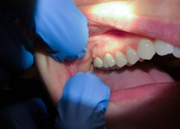 Best Emergency Tooth Extraction  in Houghton, MI