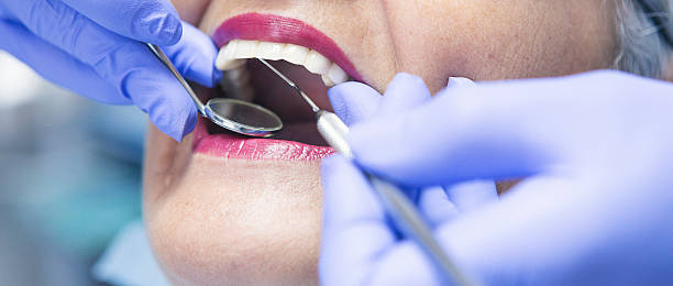 Best Knocked-Out Tooth Emergency  in Houghton, MI